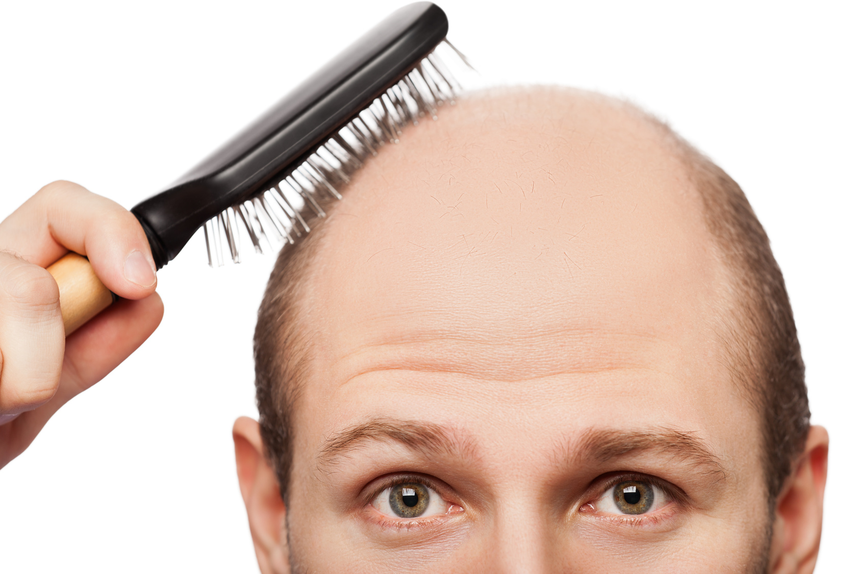 Human alopecia or hair loss - adult man hand holding comb on bald head